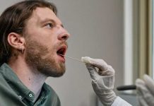 Ojo : El exceso de saliva podría ser una mala señal