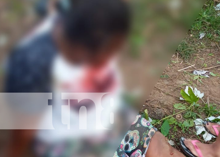 Corn Island: Mujeres lesionadas al caer con todo y motocicleta en la 'Bajada de la Muerte'