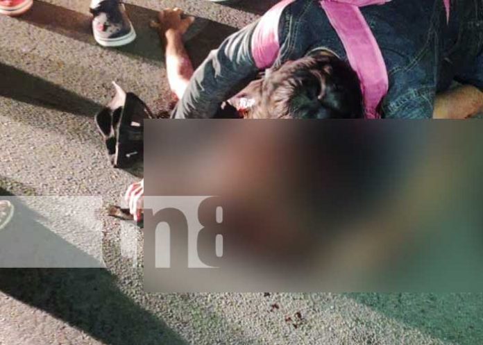 Foto: La “Zorrita” Resultó gravemente lesionado al ser arrollado por un vehículo en Juigalpa, Chontales / TN8