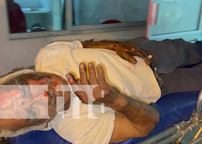 Anciano sufre quemaduras tras caer en un incendio de malezas en Chontales
