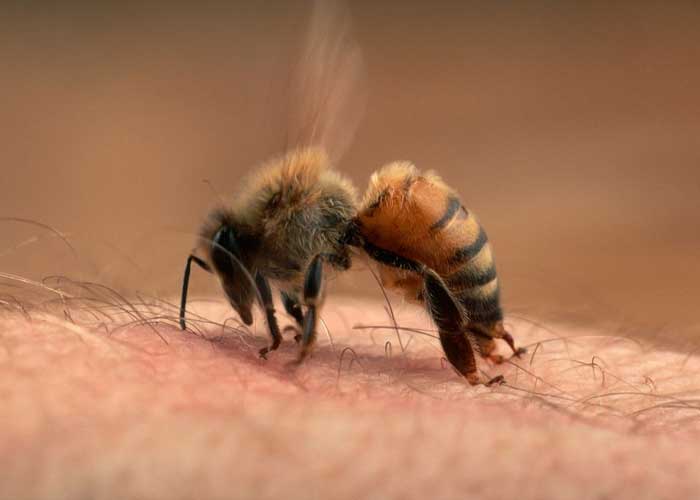 Foto: Picaduras de abejas