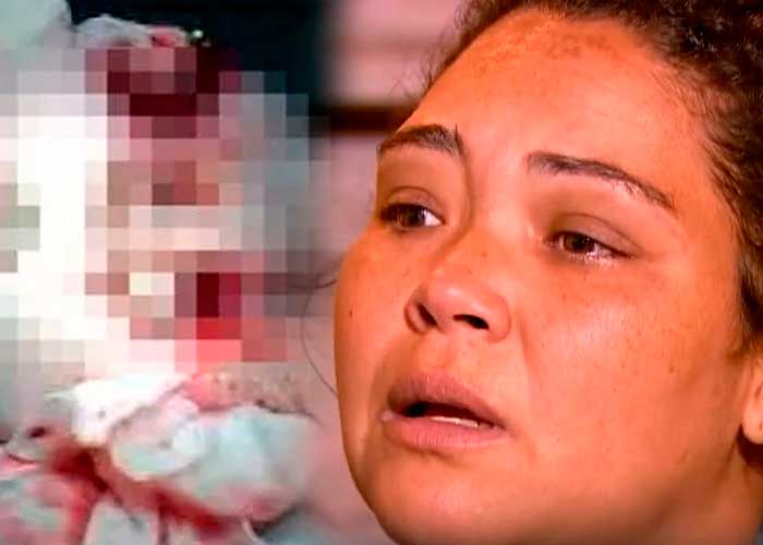 ¡Horror en Brasil! Médico le "arrancó" la cabeza a una bebé durante un parto