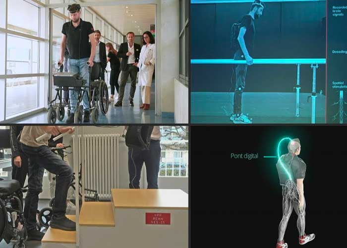 Un parapléjico vuelve a caminar gracias a 2 tecnologías