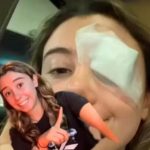 Una joven termina en el hospital por truco de belleza que vio en TikTok