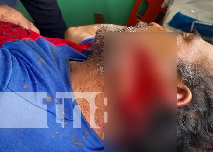 Foto: Machetazo certero: Hombre recibe ataque en vía pública en Santo Tomás, Chontales (VIDEO) / TN8