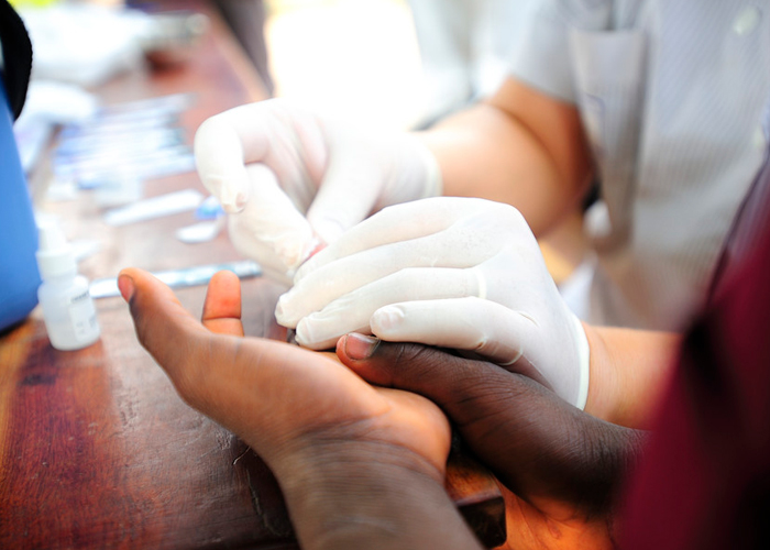 8 naciones Africanas colaboran en la búsqueda de una vacuna contra el VIH
