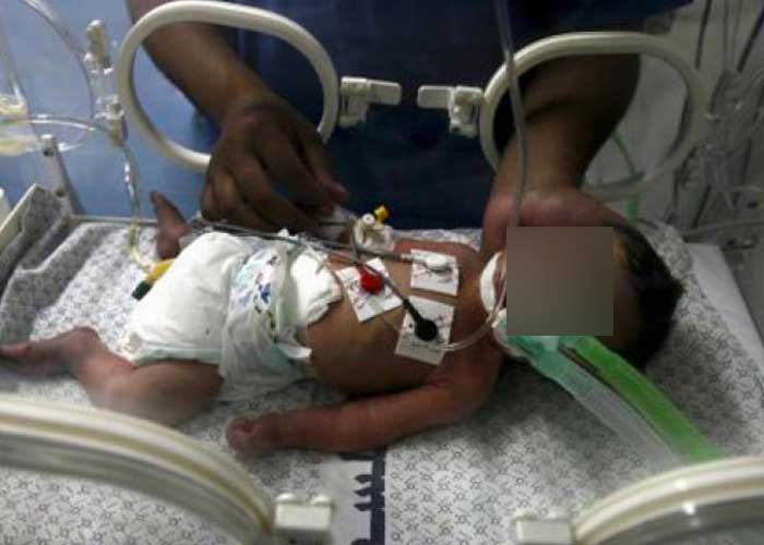 Médicos de Gaza rescatan a un bebé del vientre