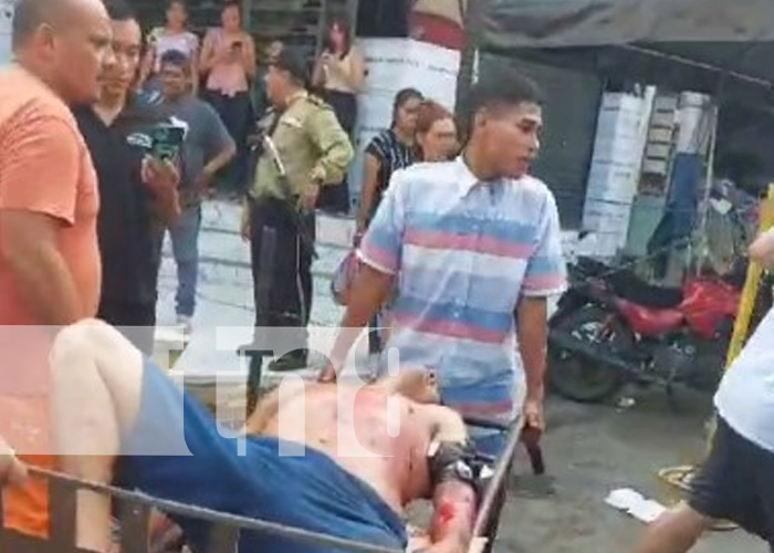 Foto: Hombre es agredido a machetazos /TN8