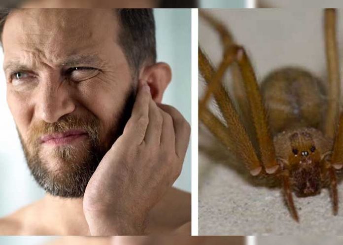 Descubren una araña con todo y su nido dentro del oído de un hombre