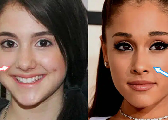 El antes y después de las cirugías de Ariana Grande (Fotos)