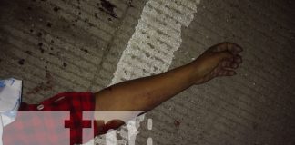 Mujer de 25 años muere tras ser atropellada por un taxi en Rosita
