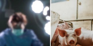 China realiza primer trasplante de riñón de cerdo a un ser humano