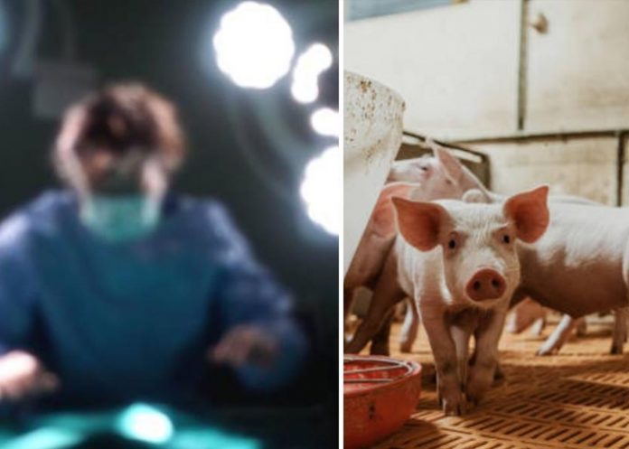 China realiza primer trasplante de riñón de cerdo a un ser humano