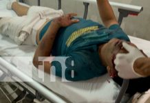 Motociclista gravemente herido tras accidente en Juigalpa