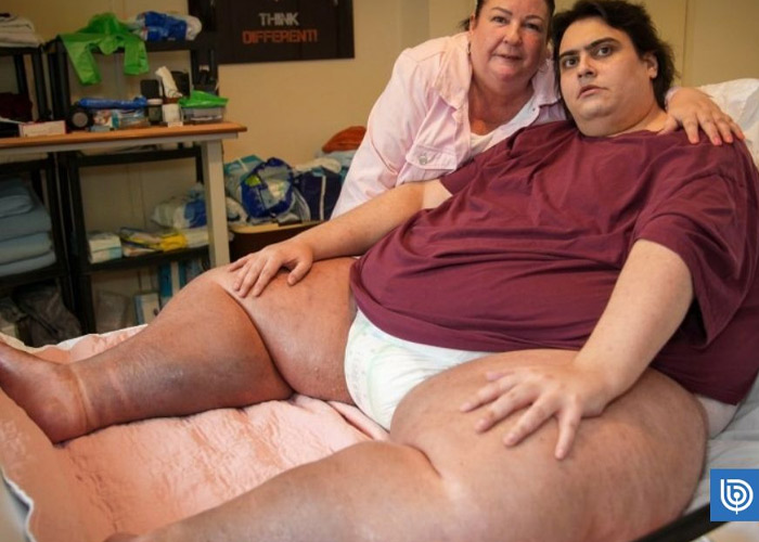 Muere uno de los hombres más obesos del Reino Unido