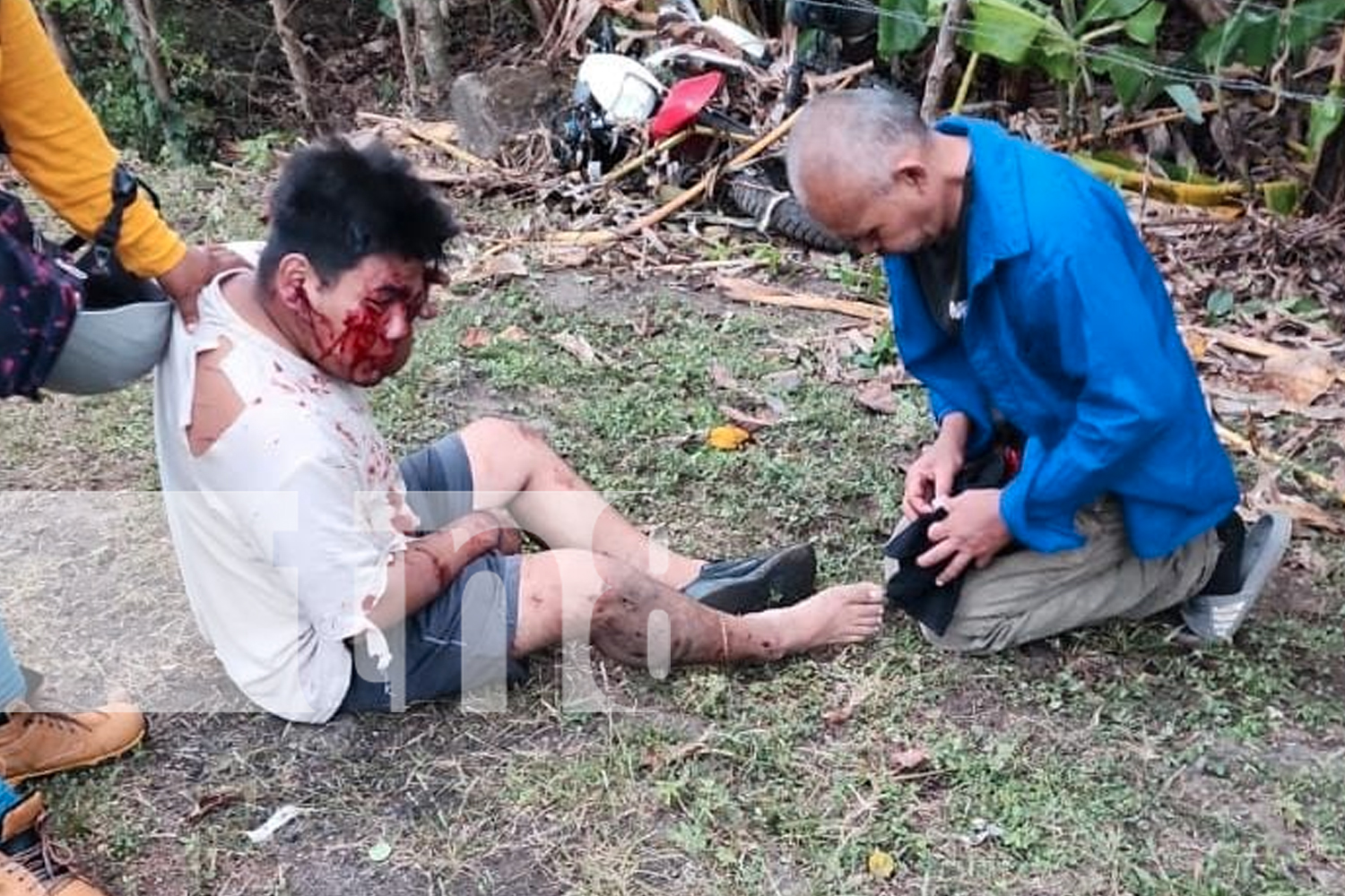 Foto: Motociclista y acompañante, terminan lesionados, tras accidente en la Isla de Ometepe/TN8