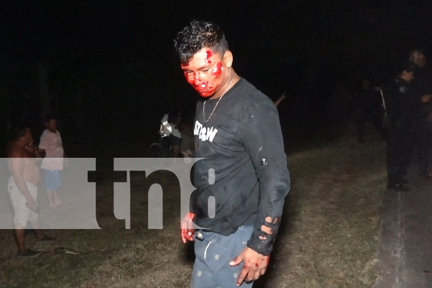 Foto: Fuerte accidente en Ometepe: Joven abandona a su amigo tras caída de moto/TN8