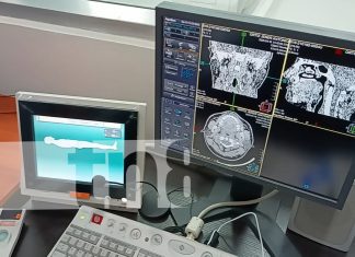Foto: Bluefields con tecnología de diagnóstico avanzada/TN8
